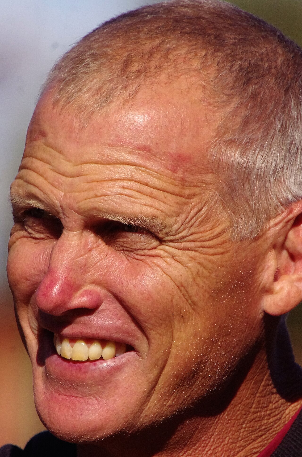 Former Australia Rugby Star Nathan Charles Diagnosed with Motor Neurone Disease